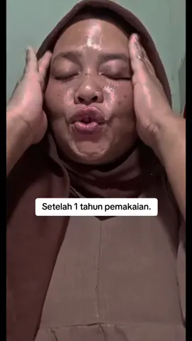 Barubaru ini, publik dikejutkan dengan pengumuman resmi dari BPOM (Badan Pengawas Obat dan Makanan) yang menyatakan bahwa salah satu produk skincare milik dr. RezaGladys yaitu Glafidsya Glowing Booster Cell tidak memiliki izin edar alias ilegal. Temuan ini mengundang kontroversi besar, terutama karena produk ini digunakan melalui metode microneedle atau jarum, yang semestinya dikategorikan sebagai obat, bukan kosmetik. Produk ilegal ini bahkan disebut BPOM termasuk dalam 16 produk kosmetik yang dicabut izin edarnya pada akhir Juli 2025 lengkap dengan potensi risiko hukum hingga 12 tahun penjara atau denda hingga Rp5 miliar jika terbukti melanggar UndangUndang Kesehatan Pasal 435.