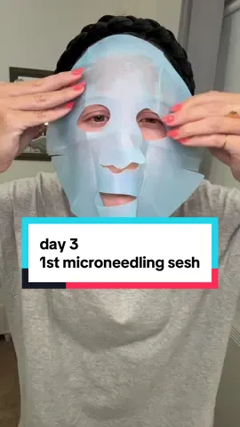day 3// it’s so hard to tell a difference when you’re used to your skin looking bad 🧐  @Revision Skincare®  #creatorsearchinsights #creatorsearchinsights #microneedling #acnetreatment #acnescars #acnejourney #skincarejourney microneedling for acne scars Acne scars Acne journey Microneedling results before and after