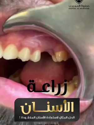 عروضنا ما زالت مستمرة ولمدة اسبوع