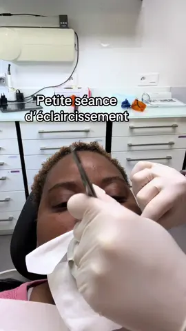#blanchimentdentaire #beauty #videoviral 