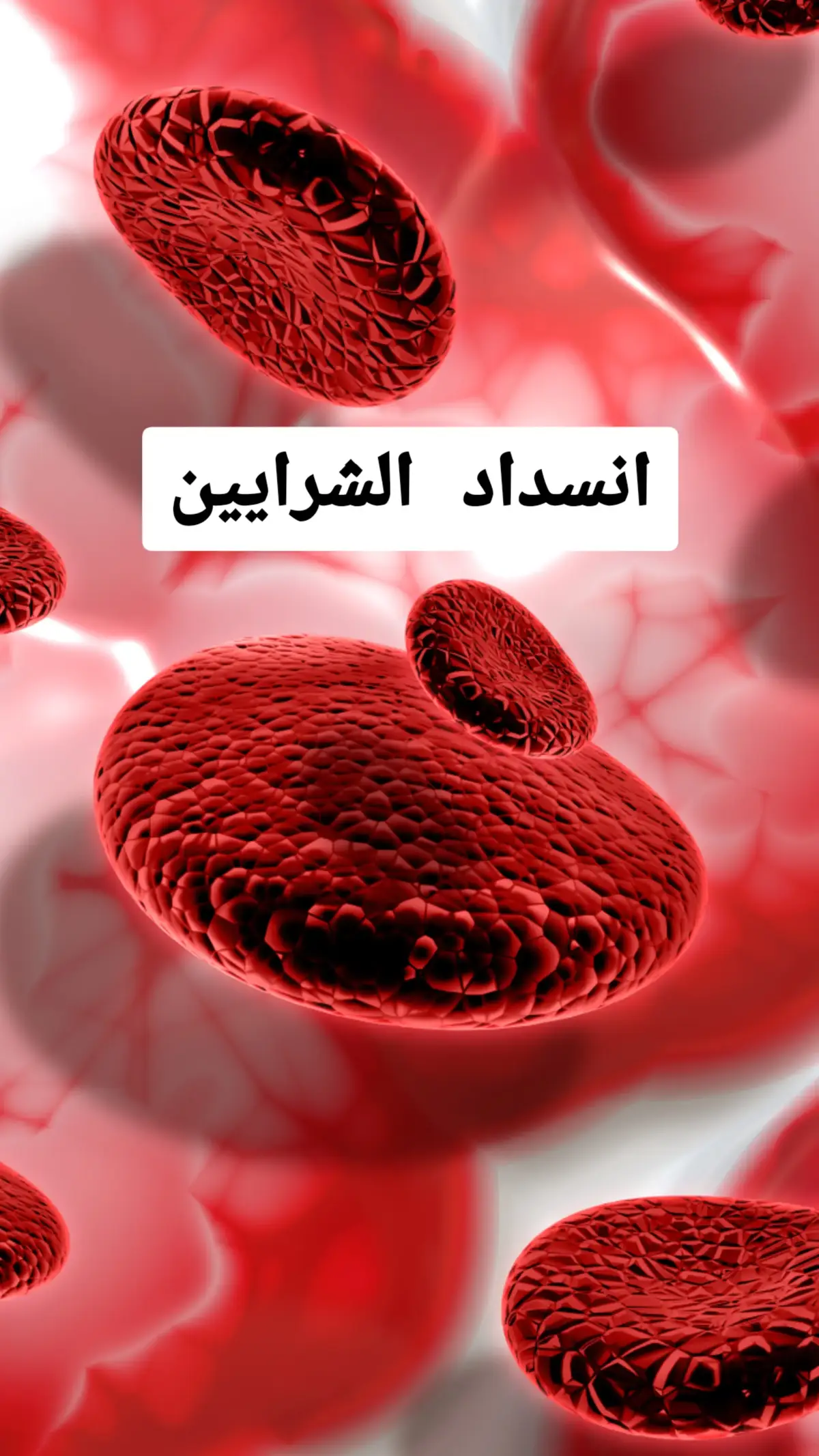افضل اطعمة تعالج انسداد الشرايين #اكل #اكلات #فواكه #خضر #خضروات #الصحة #معلومات #لايك_متابعه_اكسبلور #لايك #صحة_عامة #علاج_طبيعي #علاج #doctor #healthyliving #healthyrecipes #fact #facts #advice #doctorsoftiktok #benefits #صلي_علي_النبي 