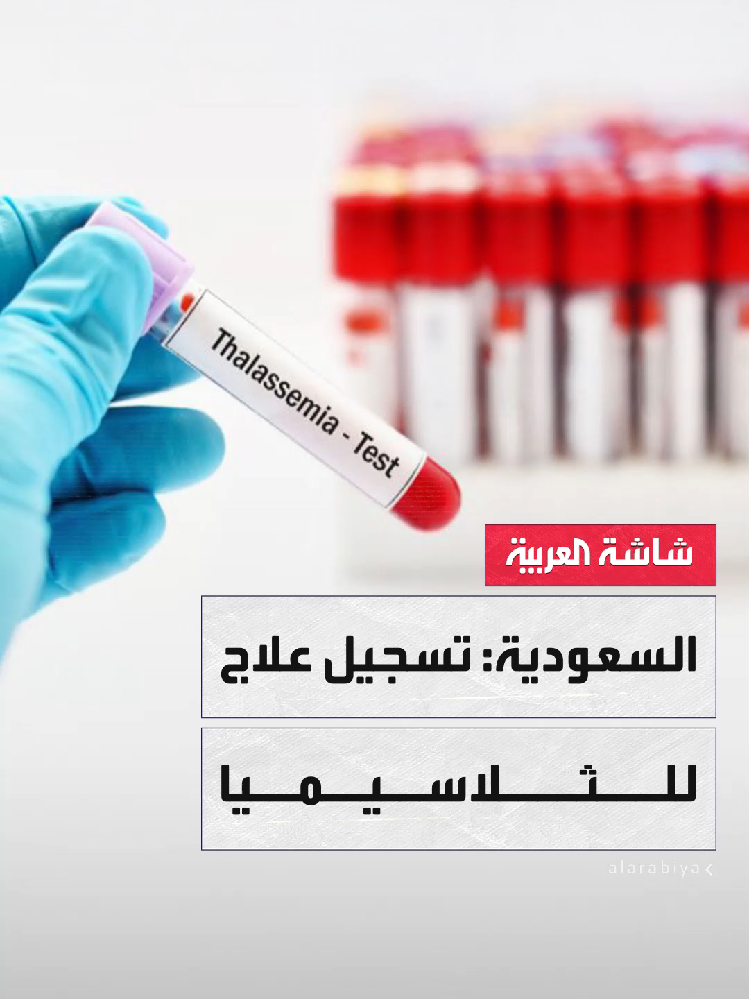 يعمل على إنتاج كرات الدم الحمراء وإطالة عمرها.. هيئة الغذاء والدواء #السعودية تسجل مستحضر