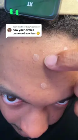 Replying to @ohboyitsjoy Favorite acne hack 🙌🏼 #skincarehack #acne #pimplepatch #skincare #hydrocolloidpatch #pimplepatchhack #hydrocolloidroll #hydrocolloid