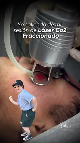 ✨ Yo saliendo de mi sesión de láser CO2 como si nada me pudiera detener. Porque cuando tu piel se siente renovada, tú también te sientes distinta. ✔️ Textura más suave ✔️ Tono más uniforme ✔️ Ese brillo natural que no se compra 💆‍♀️ Una sesión que vale cada segundo. 📍 Solo en Alma Centro Estético Láser #belleza #estetica #laserco2 #rejuvenecimiento #tacna 