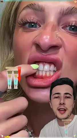 Ce dentifrice naturel est Incroyable 🦷✨! Plus besoin de bandes blanchissantes ! #dentifrice #bodyaccel #sourireparfait #dentblanche #tiktokmademebuyit  