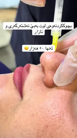‎سلێمانی-سەرچنار، بەرامبەر ئاسایشی سەرچنار📍 ‎خوار مەڵبەندی تەندروستی سەرچنار 📲:07708255656 07708255959 07509797574 #ڕۆسابلانكا #ساڵۆن #داشكاندنێكی_گەورە_و_ناوازە_نرخەكانمان_ #sarchnar🦋 #botox #offer #سلێمانی_هەولێر_کەرکوک_دهۆک 
