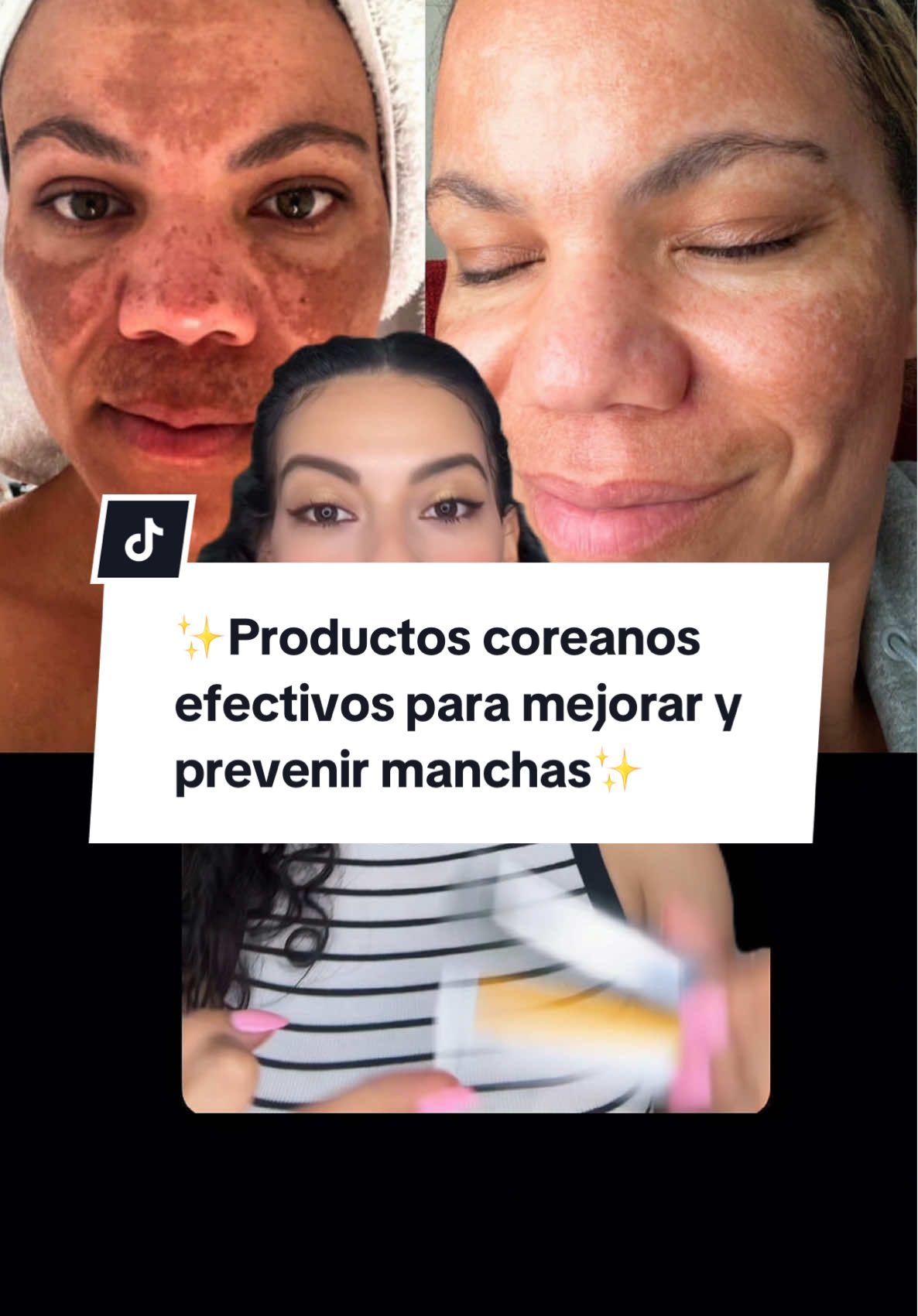 ✨Productos coreanos efectivos para mejorar y prevenir manchas✨ #tranexamicacid #koreanskincare #celimax @celimax US Store #darkspots #antiaging #antiagingskincare #tiktokshopcreatorpicks 