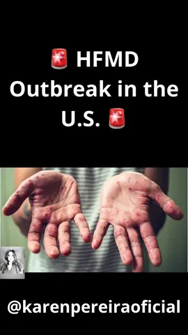 A highly contagious disease called Hand, Foot, and Mouth Disease (HFMD) is spreading in parts of the U.S. — especially among kids under 5. 📍 Virginia & U.S. Virgin Islands are seeing outbreaks, and one toddler case may have been fatal. 😷 It spreads through coughs, sneezes, contaminated surfaces, and even blister fluid. 💥 #symptoms Fever, painful mouth sores, and a rash on hands & feet. ⚠️ Rare but serious complications: dehydration, #viral meningitis, even paralysis. 🧼 There’s no vaccine, so wash your hands, disinfect surfaces, and keep sick kids home if they have fever or open sores. 🧃 Stay hydrated. Most people recover in 7–10 days. 👉 Stay safe & share to spread awareness! #viral 