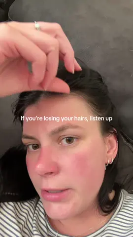 No like this is an ad but it’s also not an ad I truly grew my hair back with this stuff and I gifted it to my mom and she also has a full new set of bangs lol @BondiBoost #hairgrowthproducts 