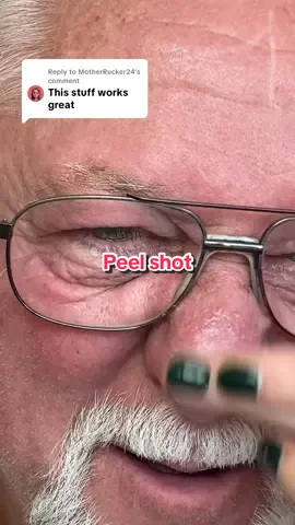 Replying to @MotherRucker24 it’s great for any skin type!! @Dr.Melaxin Global #drmelaxin #drmelaxinpeelshot #peelshot #peelshotampoule #skincare #koreanskincare #ttsbeautybesties #blackhead #blackheads #ttsdelightnow #Tiktokshopcreatorpicks #tiktokshoprestock #tiktokshopnewarrivals #tiktokshopbacktoschool #tiktokshopblackfriday #tiktokshopcybermonday 