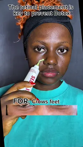 Why you need an eye cream in your routine 👀 KSecret targets crow feet,smile lines & eleven lines all in one step.  @KSECRET GLOBAL   NOTE; you don’t need that much retinal        #KSECRETGlowChallenge #KSECRET #Seoul1988 #Retinal   #ksecretglowchallenge #ksecret #seoul1988 #KSECRETGlowChallenge #eyecream #eyecreamfordarkcircle #fyp #skincare 