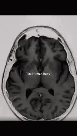 The complexity of the human body #anatomy #biology #humanbody #neuroscience #science 