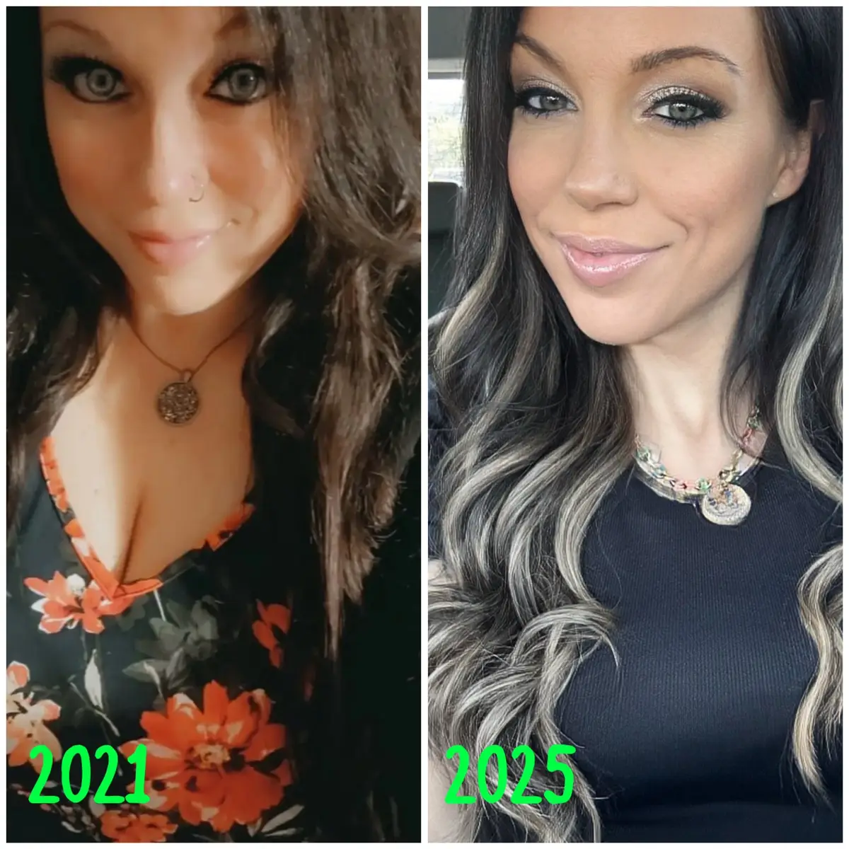 Losing so much weight changed the entire structure of my face. Sometimes it’s crazy for me to reflect on it. #fyp #weightloss #thenandnow #weightlossjourney