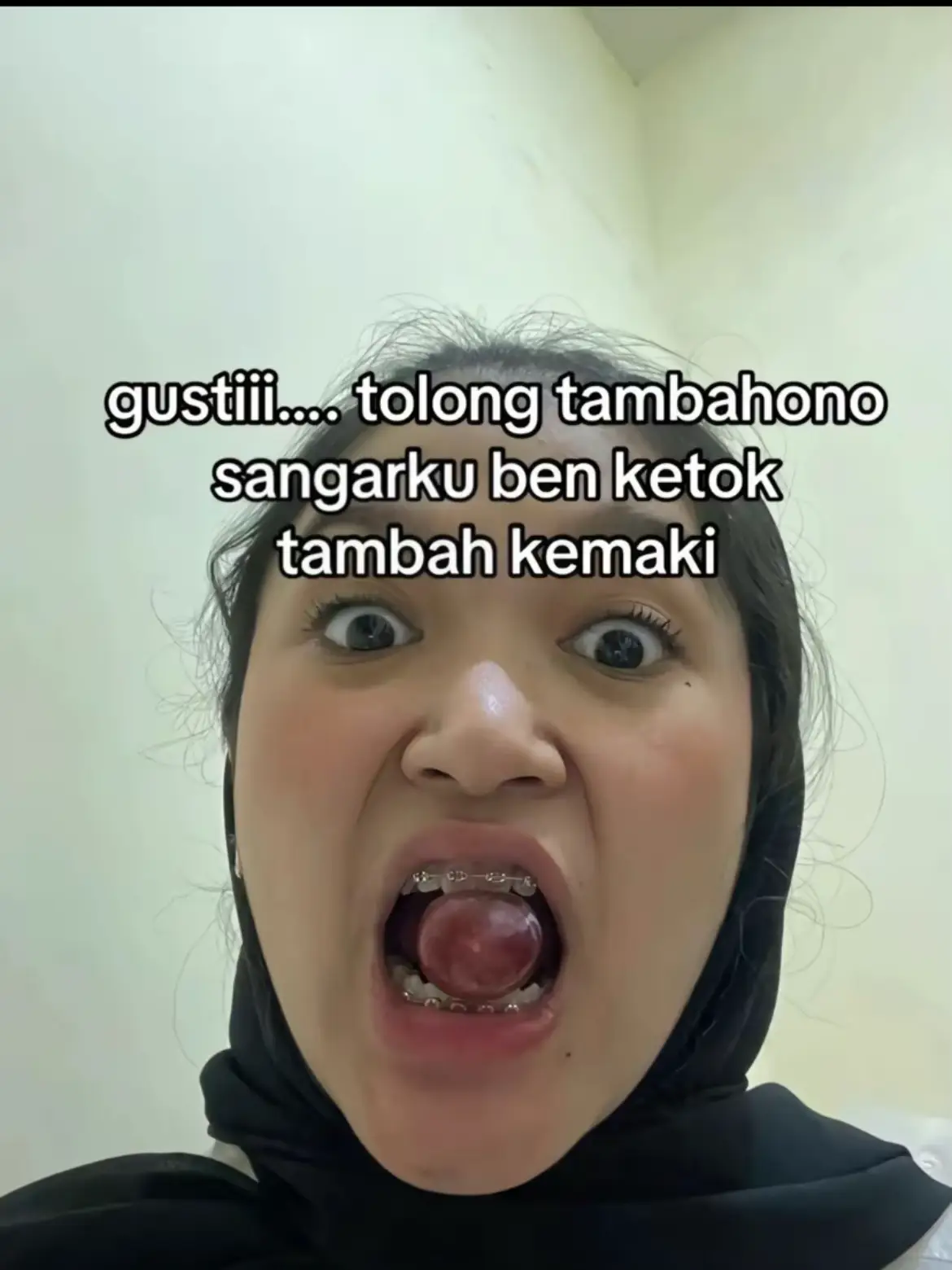 #wongsangar 