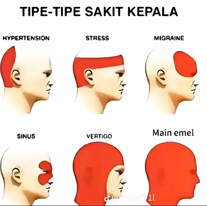 #kuerausahkakeancangkem#fyp #foryou #foryoupage #trending #viral #followme #tiktok #funny #Love #comedy #duet #xyzbca #greenscreen #VoiceEffects #facemojikeyboard #stresmaenml#stres