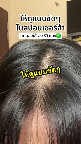 ใครผมบางตัวนี้มันช่วยได้จริงๆค่ะ #คารีนแฮร์เซรั่ม #ลดผมร่วง #ผมบางใช้อะไรดี #ผมบาง #หัวล้าน   