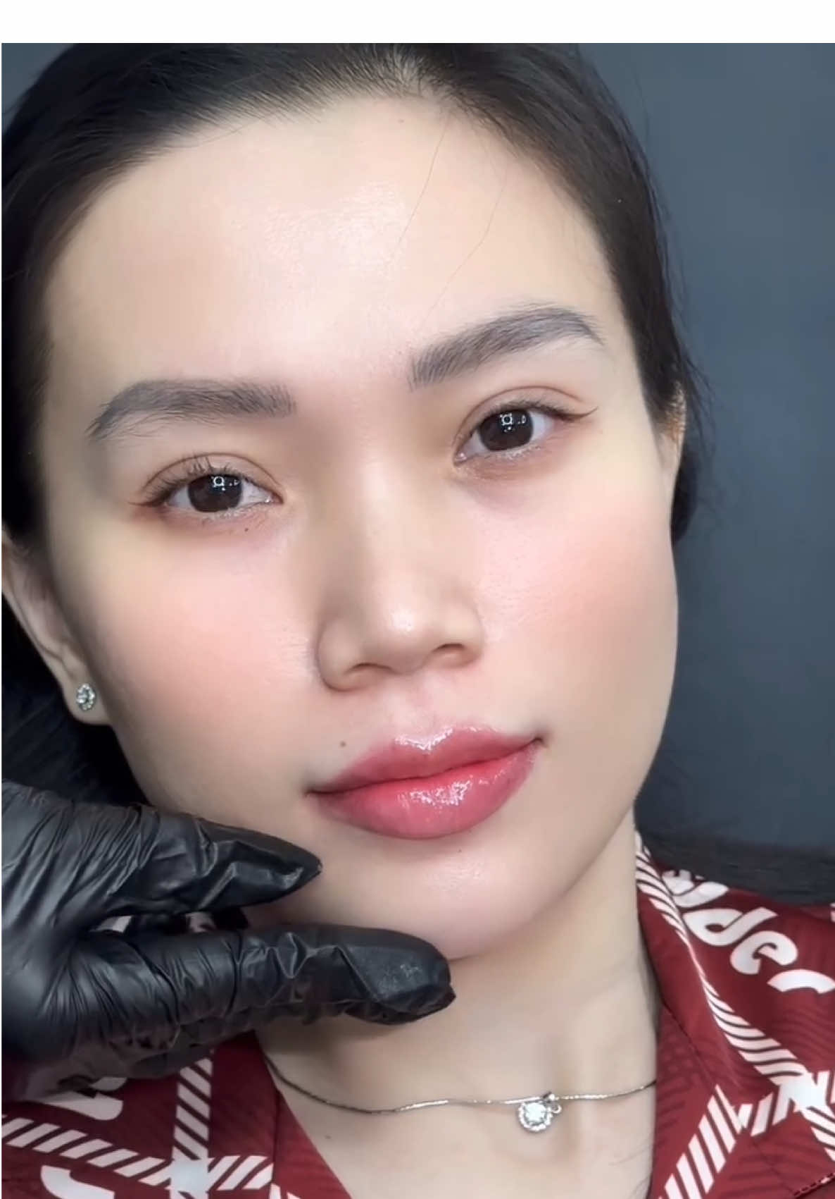 Case môi vừa hoàn thiện - ca tạo hình môi “dứt kim” cực kỳ ấn tượng! Trước đó, môi thiếu form và kém hài hòa.  Nhưng chỉ sau 30 phút thực hiện, dáng môi mới đã hiện rõ: cân đối, sắc nét và vô cùng thu hút. Cả nhà cùng nhìn kết quả và cảm nhận sự thay đổi rõ rệt nhé! #tienleacadamy #filler #botox #tienle #tiemmoifiller 