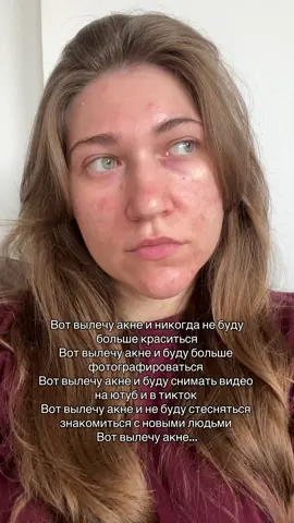 #акне #уходзалицом #системныеретиноиды #акнелечение 