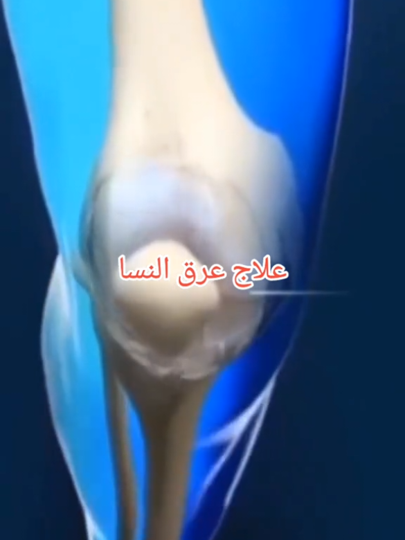 #عشبة_الدسك #عشبة_عرق_النسا #عشبة #علاج_بالاعشاب #البحرين_الدمام_الخبر_الظهران_الجبيل_الاحساء_بقيق_الفيصليه_القصيم_الريا #دبي_أبوظبي_العين_الشارقة_الفجيرة_ام_القيوين_راس_الخيمة_عجمان_الامارات #الرياض_جده_مكه_الدمام_المدينه #علاج_الابهر_الوثاب #صحة_ورشاقة #صلي_الله_علي_محمد_صلي_الله_علية_وسلم #صباح_الخير #ترند #اكسبلورexplore 