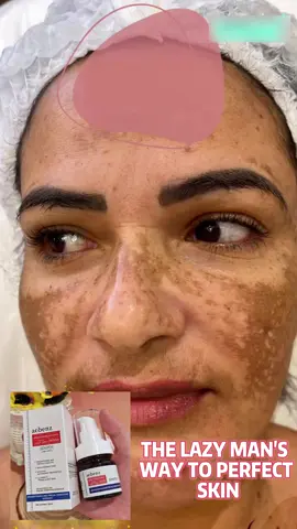 Qw Say BYE dark spots with 1 products#foryou #freckles 