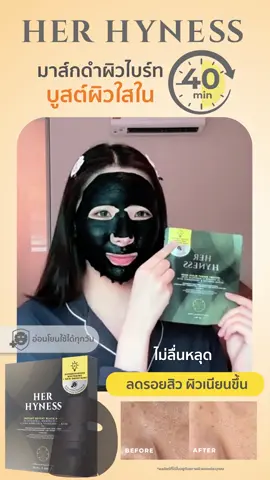 Her Hyness มาส์กดำสูตรไบร์ท แผ่นมาส์กนุ่ม เกาะหน้าดีมาก มาส์กแค่ 40 นาที ผิวใสเหมือนได้ reset ผิวใหม่เลย! #HerHyness #No1CleanBeauty 