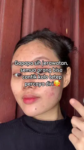 Confident🥰. #tampilpercayadiri #ENDsecure #volcanicash  