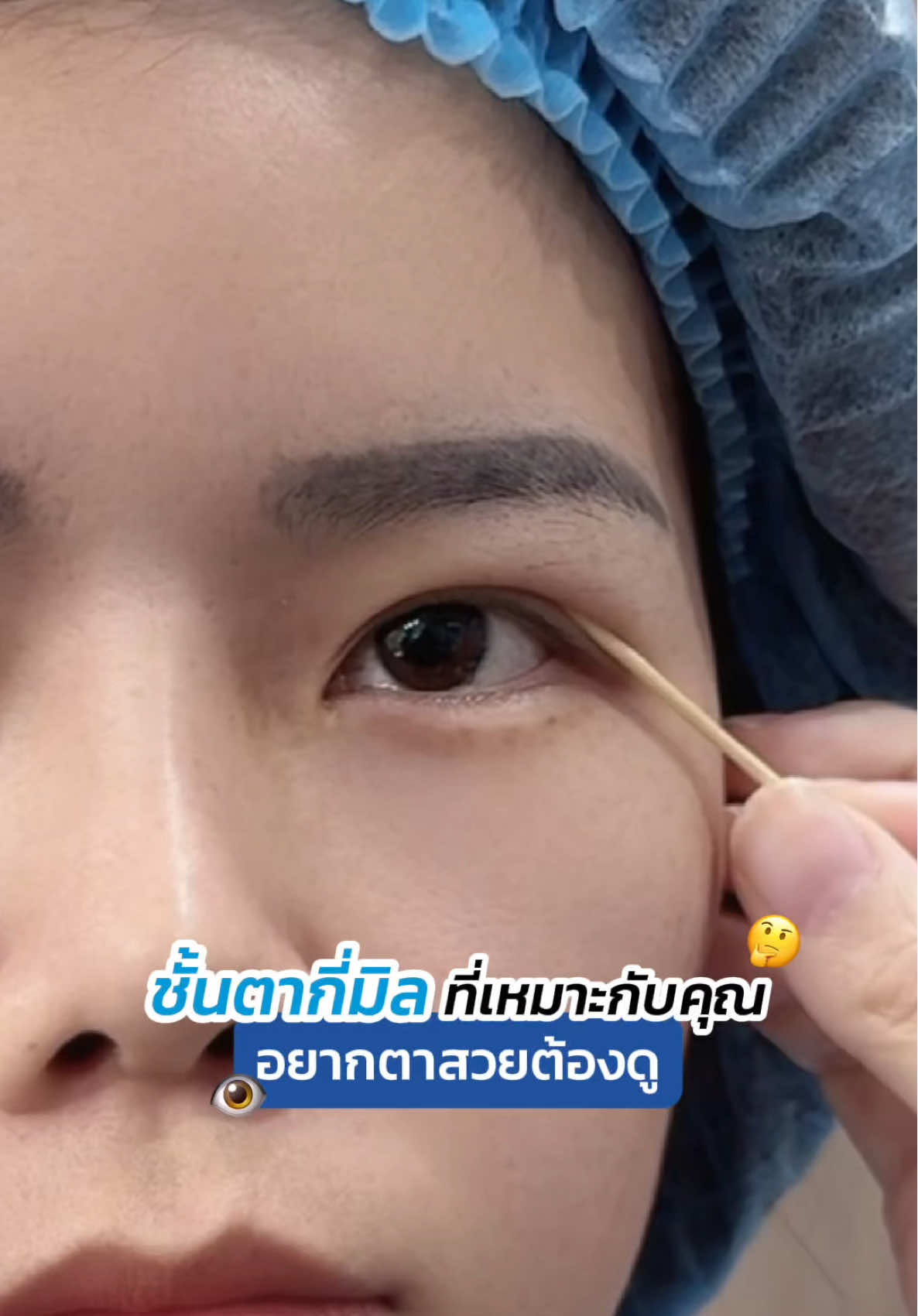 ชั้นตากี่มิล ที่เหมาะกับคุณ 🤔 อยากตาสวยต้องดู ⁉️ #skyclinic #รีวิวตาสองชั้น #หมอสกาย #ทำตาที่ไหนดี #จักษุแพทย์ #ศัลยกรรมตา #สกายคลินิก 