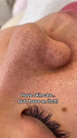 This is my favorite thing ever!! 🫠 #fyp #foryou #skincaretips #skincareaddict #cloggedpores #porecare 