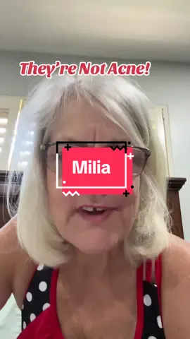 Milia are small, white or yellowish bumps that commonly appear on the face, especially around the eyes on the cheeks nose, and sometimes on the forehead or chin. They are tiny cysts filled with keratin a protein found in skin hair and nails. They form just under the surface of the skin when dead skin cells get trapped instead of naturally shedding. They are not pimples, blackheads, or whiteheads. They are not caused by bacteria or acne, and they don’t respond to typical acne treatments. #Skin #Cyst #milia 