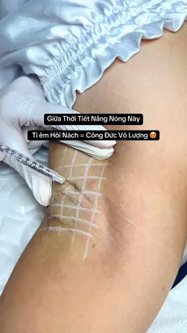 Tạm biệt mùi cơ thể, tự tin suốt ngày dài! Hiệu quả thấy rõ sau 3-5 ngày – duy trì 6-9 tháng #spaUyTínĐÀNẴNG #DượcMỹPhẩmCaoCấp #Họcnghềspa #HọcnghềspaĐÀNẴNG #camispadanang #hôi_nách #CapCut 