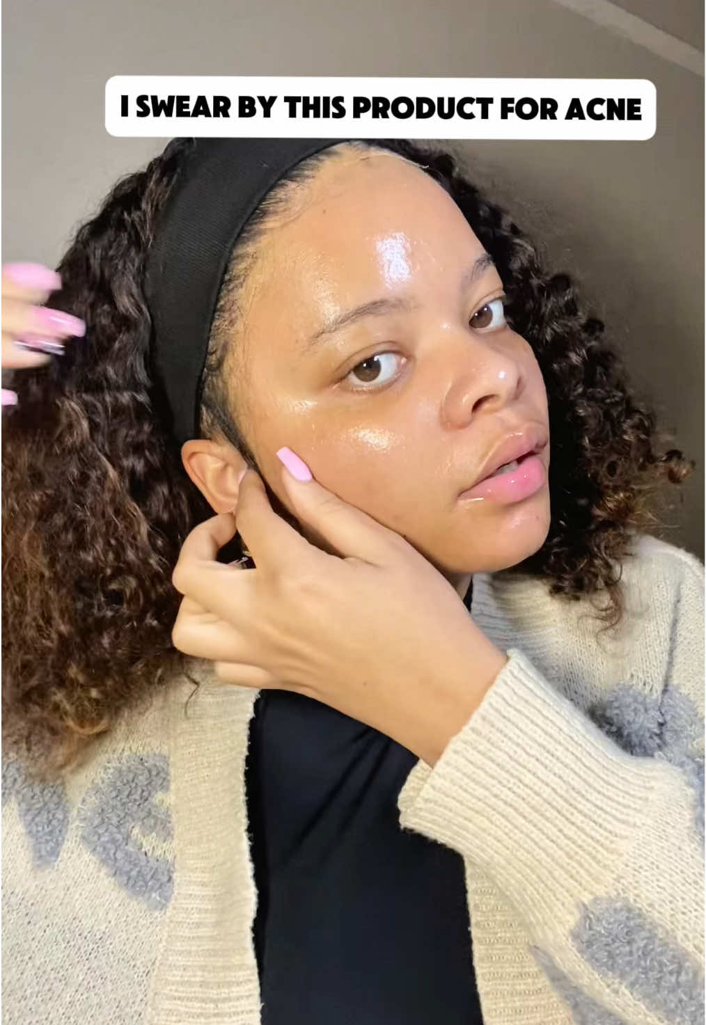 Azelaic acid: clinically proven to fight acne, calm redness & fade dark marks. Safe for all skin types, especially sensitive. This one is by @skinorenza its the acne cream 20% .#acneproneskin #azelaicacid #skinoren #acnesolution #stubbornacne 