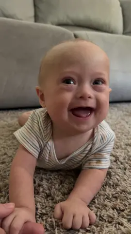 the happiest baby ever 💙💛  #dailydoseofdownsyndrome #dsawareness #dsmom #trisomy21 #downsyndrome #baby
