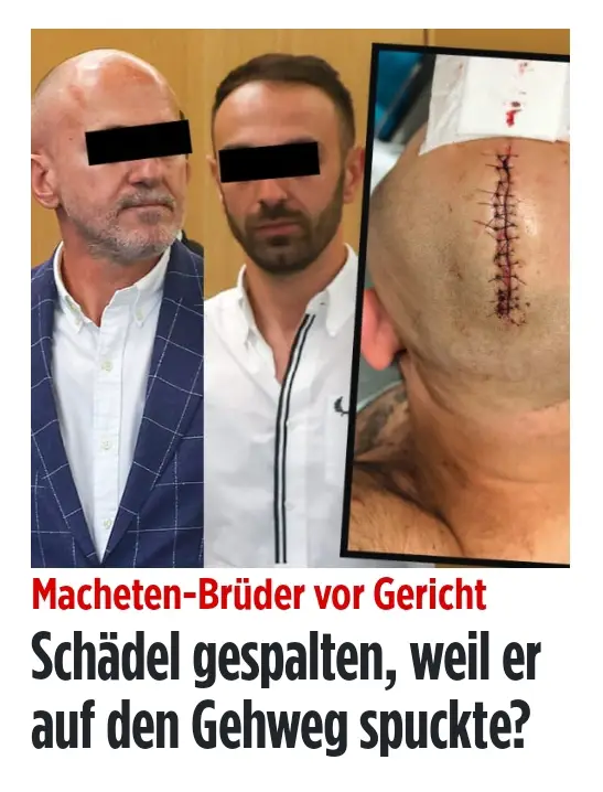 Düsseldorf (NRW) – Die Narbe ist 15 Zentimeter lang und zieht sich über den halben Hinterkopf. Isa Ö. (37) überlebte nur knapp. Sollte ihm mit einer Machete der Schädel gespalten werden? Seit Dienstag stehen zwei Brüder, 34 und 48 Jahre alt, vor dem Landgericht Düsseldorf. Versuchter Totschlag oder doch Notwehr? Das ist die Frage, die im Prozess geklärt werden soll. Der Auslöser der Eskalation: banal. Im Oktober 2024 spuckte Isa Ö. vor dem Düsseldorfer Kiosk des Angeklagten Flakron I. auf den Gehweg. Daran entzündete sich ein hitziger Streit, der zu Schubserei und Schlägen führte. Bis I. schließlich seinen Bruder Arben H. zu Hilfe rief – und Blut floss. Arben H. steig aus dem Auto, lief in den Kiosk und kehrte mit einer Machete zurück. Im Zeugenstand erzählt Isa Ö., wie der Kosovare auf ihn losging, mit der Machete zuschlug, ihm Hand und Rücken aufschlitzte und schließlich mit dem letzten Hieb seinen Kopf traf – genau in der Mitte! Kopfwunde mit 28 Stichen genäht„ Es war wie ein Blitz, dann wurde mir kalt und ich dachte, es geht zu Ende mit mir“, sagt Ö., der im Nebenjob als Security-Mann arbeitet. Blutend stolperte er davon, brach in einer Nebenstraße zusammen. Mit einer Schädelfraktur und langen Schnittwunden kam er in die Klinik, wurde notoperiert, die Kopfwunde mit 28 Stichen genäht. Arben I. flüchtete ins Ausland, wurde aber später festgenommen und landet in U-Haft.  Angeklagter: „Ich wollte ihn nur abwehren“ Am ersten Verhandlungstag stellten die Angeklagten die Tat allerdings anders dar – als Notwehr. Isa Ö. habe sich wie ein wildes Tier gebärdet und auf Flakron I. eingedroschen. Mit der Machete habe Arben H. ihn lediglich abwehren und die Attacke auf seinen kleinen Bruder beenden wollen. Den Kopf habe er versehentlich getroffen, als das Opfer sich unvermittelt vorgebeugt habe. Hintergrund soll ein monatelanger Clinch zwischen den Kioskbetreibern und der Schwiegermutter des Opfers gewesen sein, einer ehemaligen Angestellten. Wegen Unstimmigkeiten, illegalen Medikamentenverkaufs und angeblicher Kontakte ins Trinkermilieu hätten die Angeklagten ihr gekündigt. Seitdem habe sie im Viertel Stimmung gegen ihre ehemaligen Arbeitgeber gemacht. Elf Verhandlungstage sind angesetzt, im September soll das Urteil fallen. #fyp #düsseldorf #nrw #trauma #streit #kopf #deutschland 
