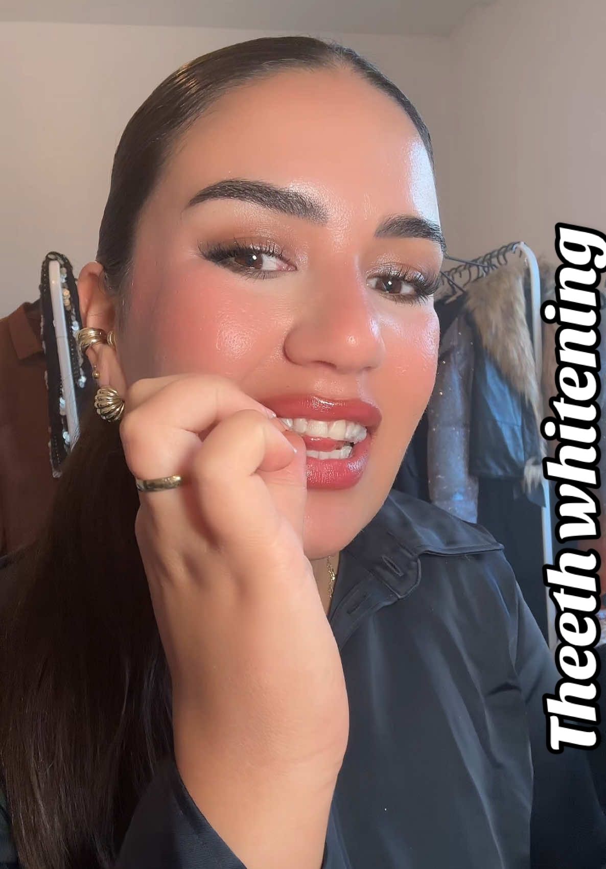 @DR.DENT - shop  Diese Teeth whitening strips sind echt gut und wirksam. #zahn #teeth #teethwhitening #whiteningstrips #zahnaufhellung 