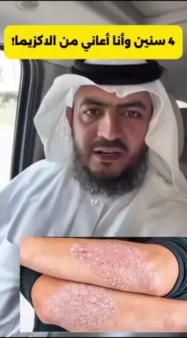 علاج الاكزيما و الصدفيه و الفطريات و الحكه علاج نهائي خلال اول 5 ايام بتلاحض الفرق  المنتج طبي و مرخص مالو اي اعراض سلبيه #فلسطين #القدس #يافا #يافا_تل_ابيب_نتانيا_عكا_حيفا_فلسطين❤️ #الداخل_المحتل_48 #رام_الله_فلسطين التوصيل متوفر لجميع المناطق مجانا 🎁🚘