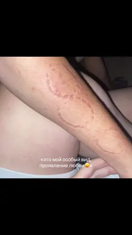 больно мб 