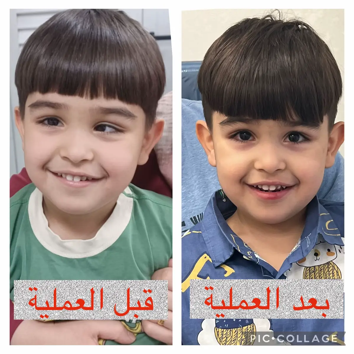 #العيون #علاج_الحول_عند_الاطفال #العيون_الحلوة #الماء_الأبيض #الحول_الانسي #علاج_الحول #مصر_السعوديه_العراق_فلسطين #مصر