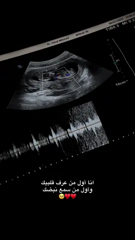 الحمدلله 🤍 #ترند #اكسبلور #fypシ #fppppppppppppppppppp #H #اكسبلور 
