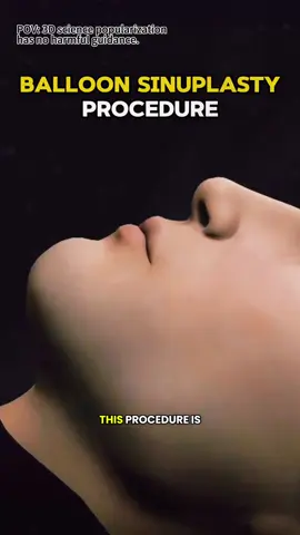 Balloon Sinuplasty Procedure (3D Animation) #balloonsinuplasty #sinuplastyawareness #sinuplasty #sinusitis #sinussurgery #nosesurgrey #sinusrelief #medical3danimation #3dmedicalanimation