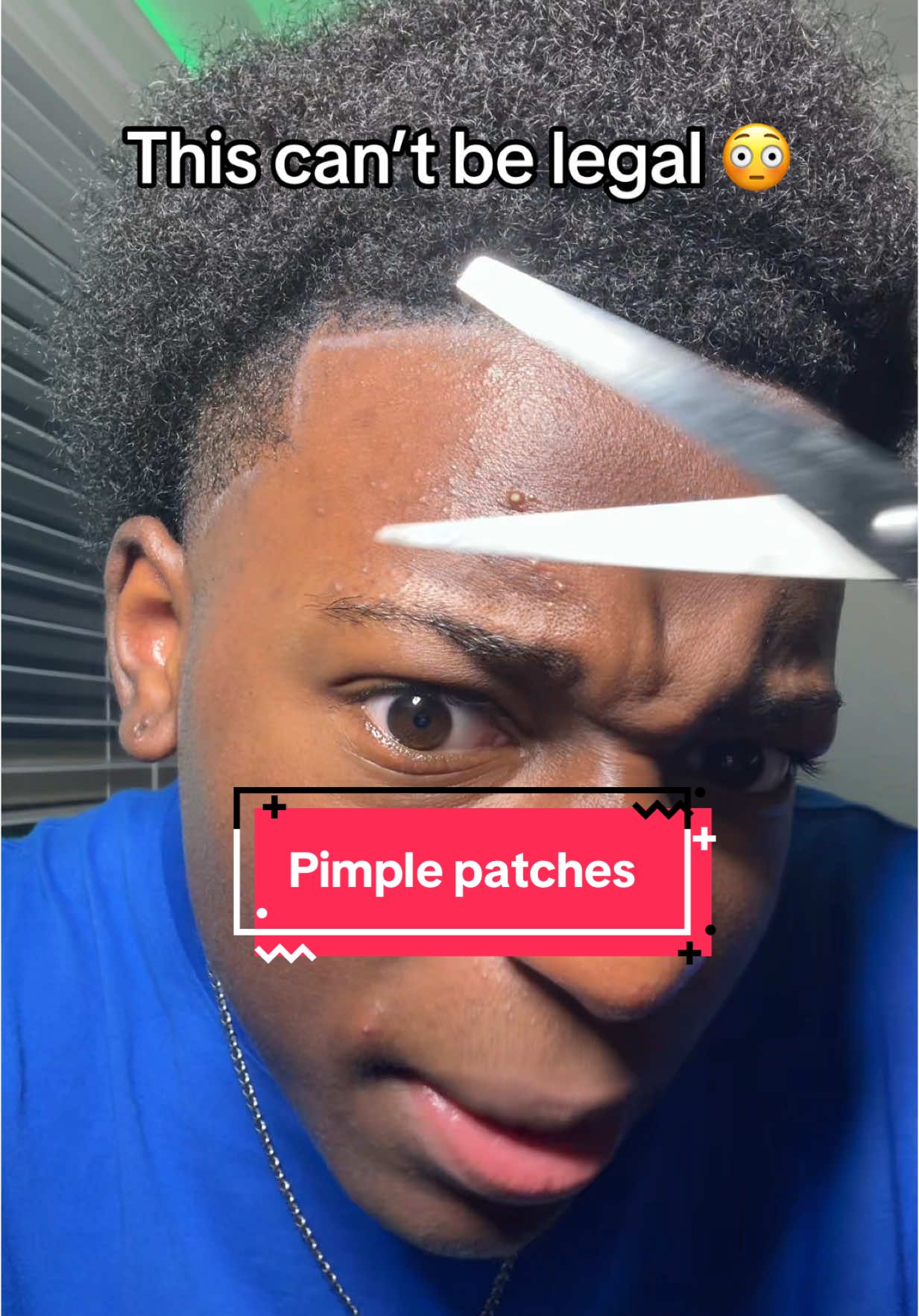 Pimple patches became this cheap #pimplepatch #pimplepatches #acne #hydrocolloidbandages #tiktokshopfinds #tiktokshopmademebuyit 