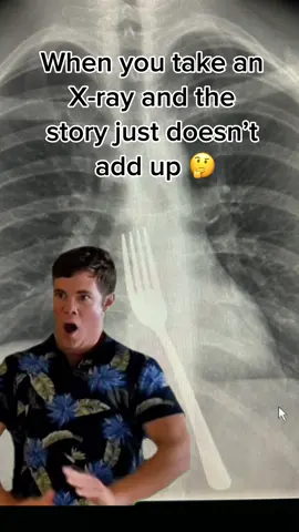 #MemeCut #Meme #MemeCut #radiology #xray #hospital #radlife 
