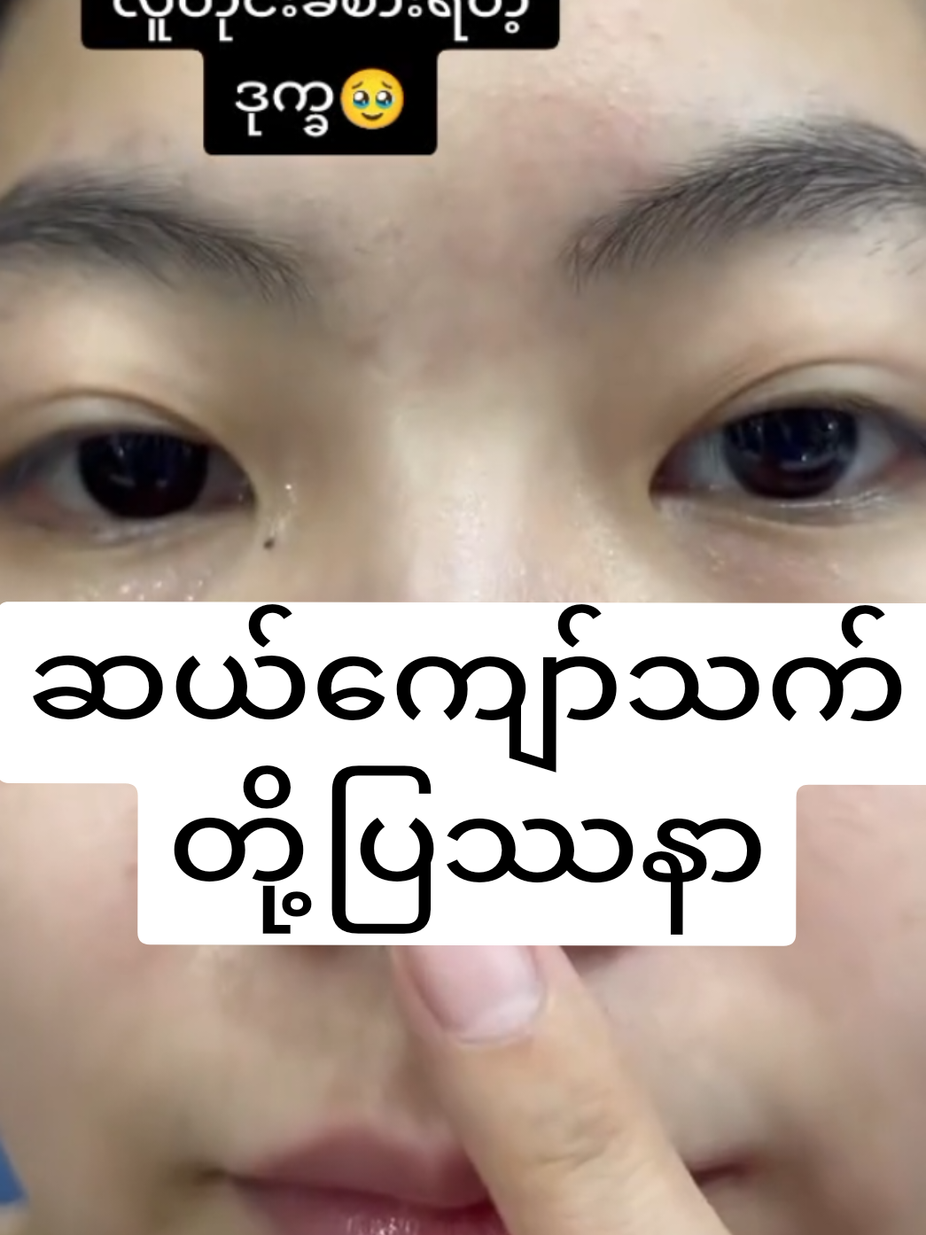 #၀က်ခြံပျောက်ချင်သူများသာကြည့်ရန် #မျက်နှာဖြူချင်သူများတွက် #သဘာ၀မင်းဂွတ်သီးမျက်နှာသစ်ဆပ်ပြာ #mimiboo238 #juulifacialsoap💜 