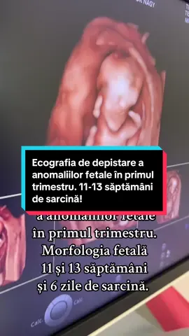 Rolurile acestei evaluări, de la finalul primului trimestru ✅ Confirmarea fătului viu  ✅ Determinarea vârstei gestaționale ✅ Determinarea numărului de feți ✅ Evaluarea anatomiei sarcinii  Tot acum se realizează testările pentru sindromul Down, Edwards și Patau.  Te așteptăm la 𝐆𝐈𝐍𝐄𝐂𝐇𝐎, 𝐂𝐞𝐧𝐭𝐫𝐮𝐥 𝐦𝐞𝐝𝐢𝐜𝐚𝐥 𝐩𝐞𝐧𝐭𝐫𝐮 𝐬𝐚̆𝐧𝐚̆𝐭𝐚𝐭𝐞𝐚 𝐟𝐞𝐦𝐞𝐢𝐢, cu o echipă de medici de elită, completată de tehnologie de vârf. Mai multe detalii: https://www.ginecho.ro/ ———————————  𝐂𝐨𝐧𝐭𝐚𝐜𝐭: ☎️ 0371.710.710 ☎️ 0771.201.201 📌 Bulevardul 1 Mai, Bl. D4A, Zona Ciupercă, Craiova  📌Craiova, Str. Calea București, Nr.34, Bl. A8, parter, în zona Rotonda, lângă farmacia Siti Pharma #viral #ecografie #morfologie #dublutest #sarcina 