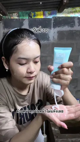 เต็มสิบรอยจางลงมาก🥹👑#เรียกฉันว่าแก้มกี้ #ดูแลตัวเอง #grwm #GRWM #ล้างหน้า #SkintificTH #โฟมล้างหน้า #โฟมล้างหน้าลดสิว #skintific 
