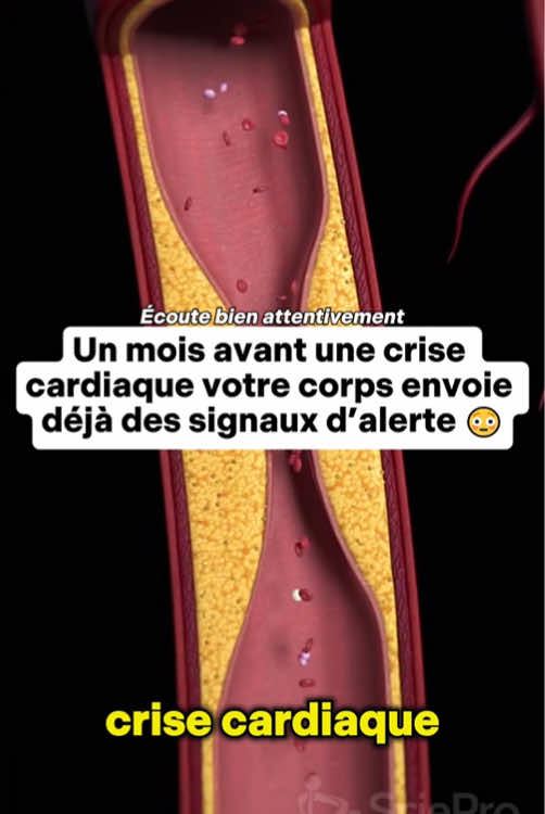 Un mois avant une crise cardiaque, votre corps envoie déjà des signaux d’alerte. #fyp #santé #shilajit #nourriture #france 