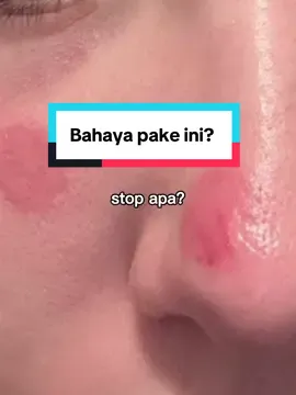 Ikuti anjuran pakai setiap produk guys! Terutama kalau ada bahan aktif untuk jerawat yang bisa bikin kulit kering atau iritasi ya bila tidak tepat. Acne patch ini keliatannya simple tapi HARUS HATI-HATI pemilihannya  #acnepatch #jerawat 