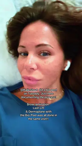 Have questions?? Drop them below or DM me ! I highly recommend @Kalie Stout  with Alchemy Aesthetics!! #skin #skincareroutine #SelfCare #foryou 