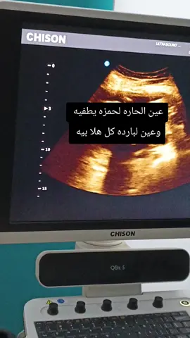 #عين #الحاره #صلي_علي_النبي_محمد_صلي_الله_عليه #صلي_على_محمد 