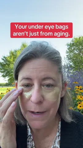 These #zozu avocado eye masks help ease under eye puffiness, bags and dark lines all at a great price! #avocadoeyemask #undereyebags #lowerbleph #tiktokshopcreatorpicks 
