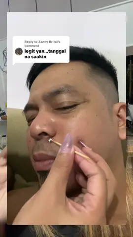 Replying to @Zanny Brital kasoy cream legit to #trending #kasoycream #removal #fyp 